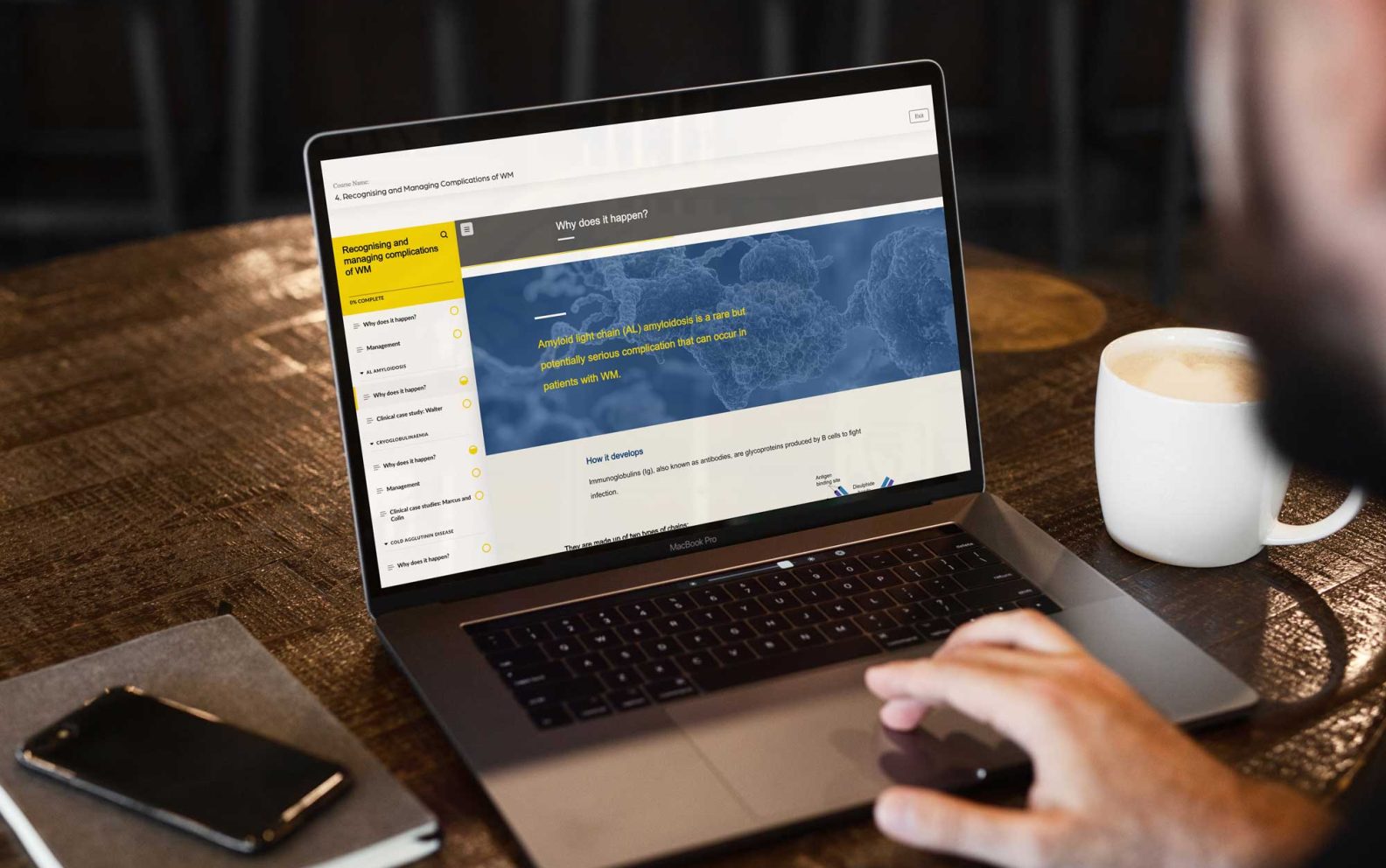 Recognising and Managing Complications of WM